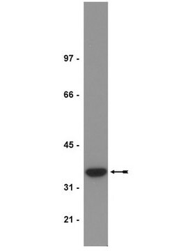 Anti-PP2A Antibody, C subunit, demethylated, clone 4b7 ascites fluid, clone 4b7, Upstate&#174;