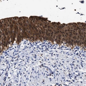 Anti-PRPF4B antibody produced in rabbit Prestige Antibodies&#174; Powered by Atlas Antibodies, affinity isolated antibody, buffered aqueous glycerol solution