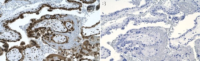 Anti-Cyclin E Antibody, clone 1C7 ZooMAb&#174; Rabbit Monoclonal recombinant, expressed in HEK 293 cells