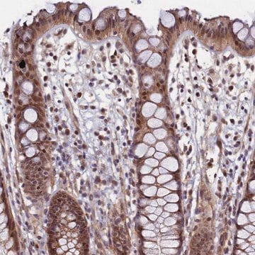 Anti-LEO1 antibody produced in rabbit Prestige Antibodies&#174; Powered by Atlas Antibodies, affinity isolated antibody, buffered aqueous glycerol solution