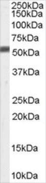 Anti-FACE1/ZMPSTE24 antibody produced in goat affinity isolated antibody, buffered aqueous solution