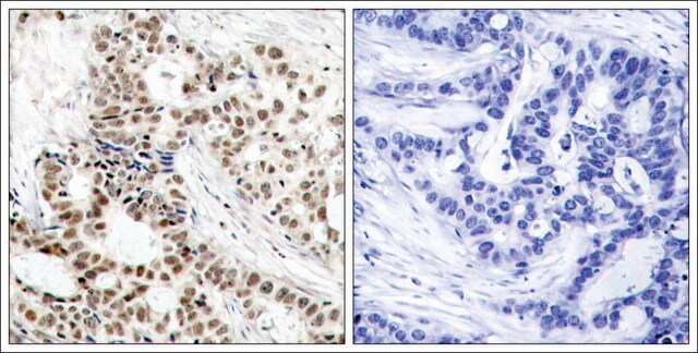 Anti-phospho-BRCA1 (pSer1423) antibody produced in rabbit affinity isolated antibody