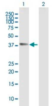 Anti-CHI3L1 antibody produced in mouse purified immunoglobulin, buffered aqueous solution