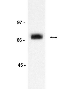 Anticuerpo anti-p75NTR (receptor de neurotrofina), clon ME20.4 clone A16/17, Upstate&#174;, from mouse