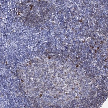 Anti-Cd79A Antibody Produced In Rabbit Prestige Antibodies&#174; Powered by Atlas Antibodies, affinity isolated antibody, buffered aqueous glycerol solution