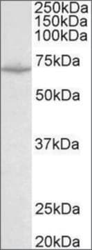 Anti-SLC6A8 antibody produced in goat affinity isolated antibody, buffered aqueous solution