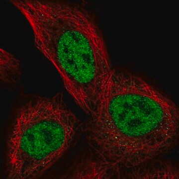 Anti-TSSC4 antibody produced in rabbit Prestige Antibodies&#174; Powered by Atlas Antibodies, affinity isolated antibody