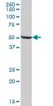 抗ALDH7A1抗体 マウス宿主抗体 IgG fraction of antiserum, buffered aqueous solution