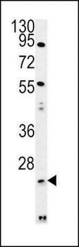 ANTI-LYPL1 (CENTER) antibody produced in rabbit affinity isolated antibody, buffered aqueous solution