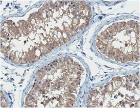 Anti-Retinal Dehydrogenase 1/ALDH1A1 Antibody, clone 8D7.1 clone 8D7.1, from mouse