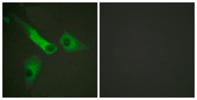 Anti-CASP9 antibody produced in rabbit affinity isolated antibody