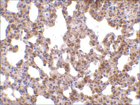 Anti-TRPC6 (ab1) antibody produced in rabbit affinity isolated antibody, buffered aqueous solution