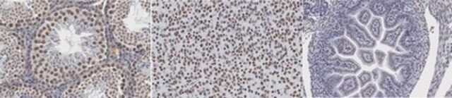 Anti-Tex19.1 Antibody, clone 7TEX-1F11 clone 7TEX-1F11, from mouse