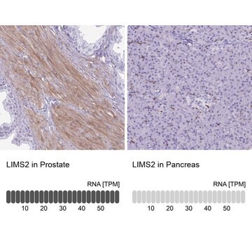 Anti-LIMS2 antibody produced in rabbit Prestige Antibodies&#174; Powered by Atlas Antibodies, affinity isolated antibody, buffered aqueous glycerol solution