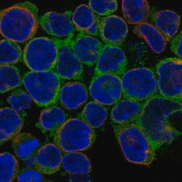 Anti-Ubash3B Antibody Produced In Rabbit Prestige Antibodies&#174; Powered by Atlas Antibodies, affinity isolated antibody, buffered aqueous glycerol solution