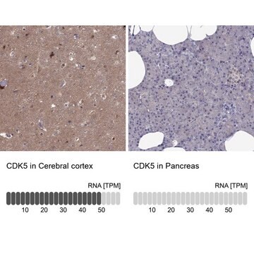 抗CDK5抗体 ウサギ宿主抗体 Prestige Antibodies&#174; Powered by Atlas Antibodies, affinity isolated antibody