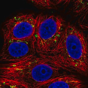 Anti-SLC35E1 antibody produced in rabbit Prestige Antibodies&#174; Powered by Atlas Antibodies, affinity isolated antibody