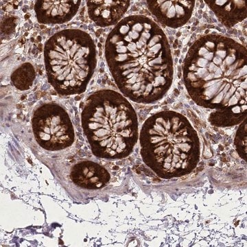 Anti-LGALS9 antibody produced in rabbit Prestige Antibodies&#174; Powered by Atlas Antibodies, affinity isolated antibody, buffered aqueous glycerol solution