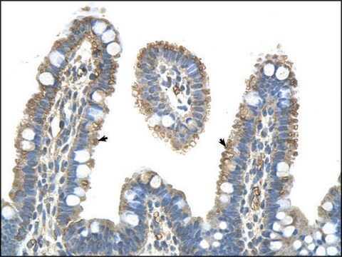 Anti-PANX1 affinity isolated antibody