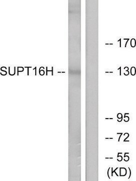 Anti-SUPT16H antibody produced in rabbit affinity isolated antibody