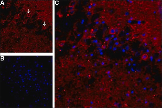 Anti-APP antibody produced in rabbit ~1.0&#160;mg/mL, affinity isolated antibody