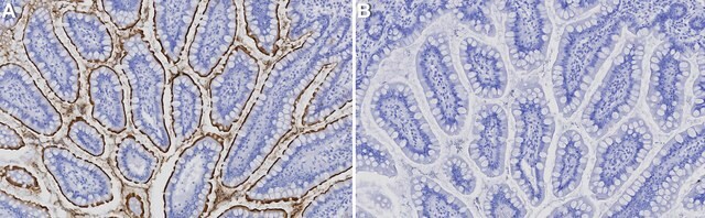 Anti-SGLT-1 Antibody, clone 1K16 ZooMAb&#174; Rabbit Monoclonal recombinant, expressed in HEK 293 cells