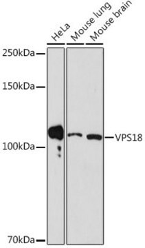 Anti-VPS18 antibody produced in rabbit