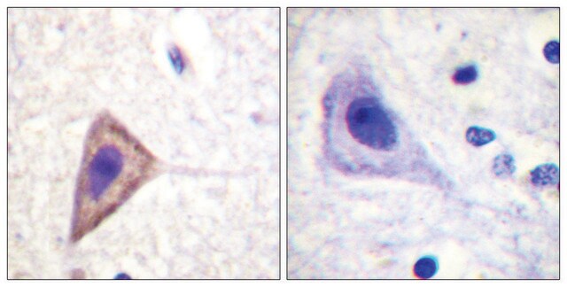 Anti-KV1.3 antibody produced in rabbit affinity isolated antibody