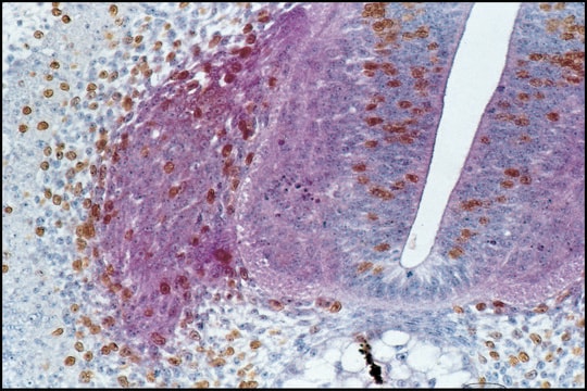 Monoclonal Anti-HNK-1/N-CAM (CD57) antibody produced in mouse clone VC1.1, ascites fluid, buffered aqueous solution