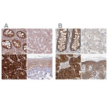 Anti-GPD2 antibody produced in rabbit Prestige Antibodies&#174; Powered by Atlas Antibodies, affinity isolated antibody, buffered aqueous glycerol solution