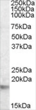 Anti-CRYAB antibody produced in goat affinity isolated antibody, buffered aqueous solution