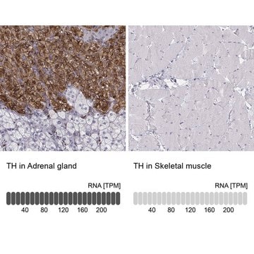 抗TH 兔抗 affinity isolated antibody, buffered aqueous glycerol solution