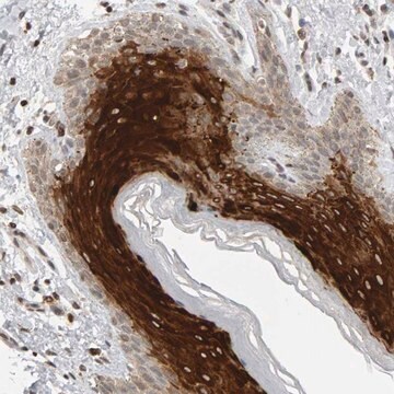 Anti-TRAM1 antibody produced in rabbit Prestige Antibodies&#174; Powered by Atlas Antibodies, affinity isolated antibody, buffered aqueous glycerol solution