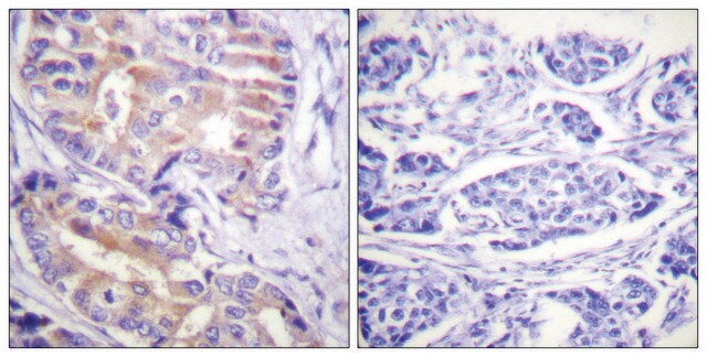 Anti-p70 S6 Kinase antibody produced in rabbit affinity isolated antibody