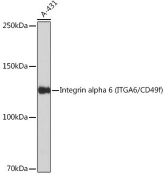 Anti-Integrin alpha 6 (ITGA6/CD49f) Antibody, clone 2R5F1, Rabbit Monoclonal