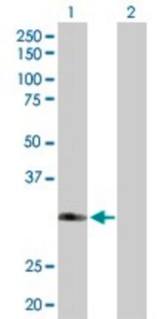 Anti-FBXO6 antibody produced in rabbit purified immunoglobulin, buffered aqueous solution