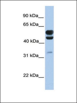 Anti-C3ORF64 antibody produced in rabbit affinity isolated antibody