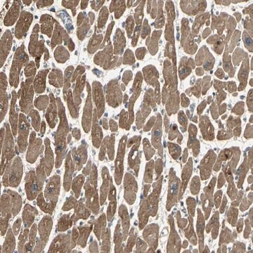 Anti-KANK1 antibody produced in rabbit Prestige Antibodies&#174; Powered by Atlas Antibodies, affinity isolated antibody, buffered aqueous glycerol solution