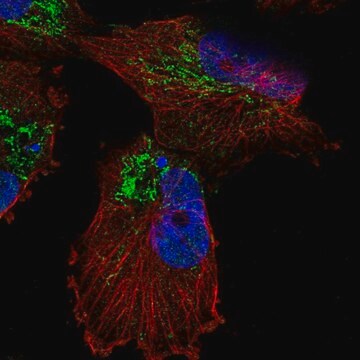 Anti-SLC25A14 antibody produced in rabbit Prestige Antibodies&#174; Powered by Atlas Antibodies, affinity isolated antibody