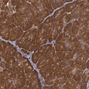 Anti-USP14 antibody produced in rabbit Prestige Antibodies&#174; Powered by Atlas Antibodies, affinity isolated antibody, buffered aqueous glycerol solution