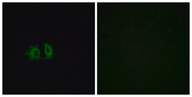 Anti-FZD5 antibody produced in rabbit affinity isolated antibody