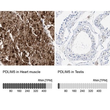 Anti-PDLIM5 antibody produced in rabbit Prestige Antibodies&#174; Powered by Atlas Antibodies, affinity isolated antibody, buffered aqueous glycerol solution