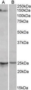 Anti-RBM20 antibody produced in goat affinity isolated antibody, buffered aqueous solution