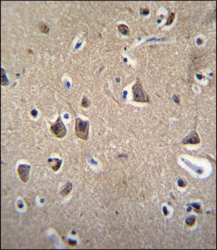 ANTI-FADS6 (C-TERM) antibody produced in rabbit IgG fraction of antiserum, buffered aqueous solution