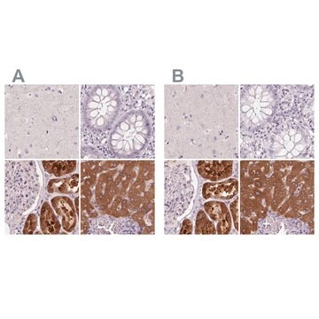 Anti-FTCD antibody produced in rabbit Prestige Antibodies&#174; Powered by Atlas Antibodies, affinity isolated antibody, buffered aqueous glycerol solution