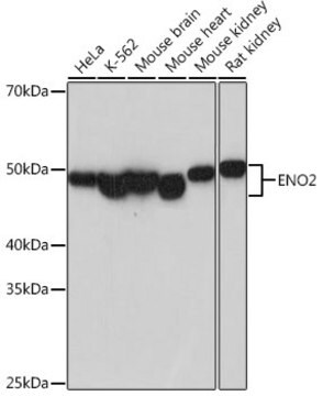 Anti-ENO2 Antibody, clone 9B4Y4, Rabbit Monoclonal