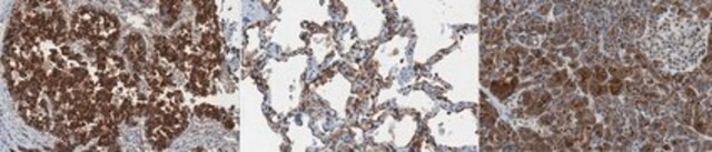 Anti-MUC1 Antibody, clone HMFG2 clone HMFG2, from mouse