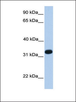 Anti-ACRV1 antibody produced in rabbit affinity isolated antibody