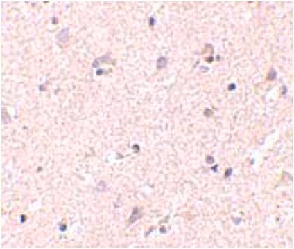 Anti-NANOS1 Antibody from rabbit, purified by affinity chromatography