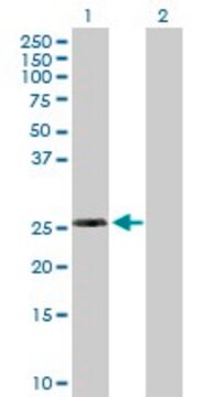 Anti-RPL10L antibody produced in mouse purified immunoglobulin, buffered aqueous solution